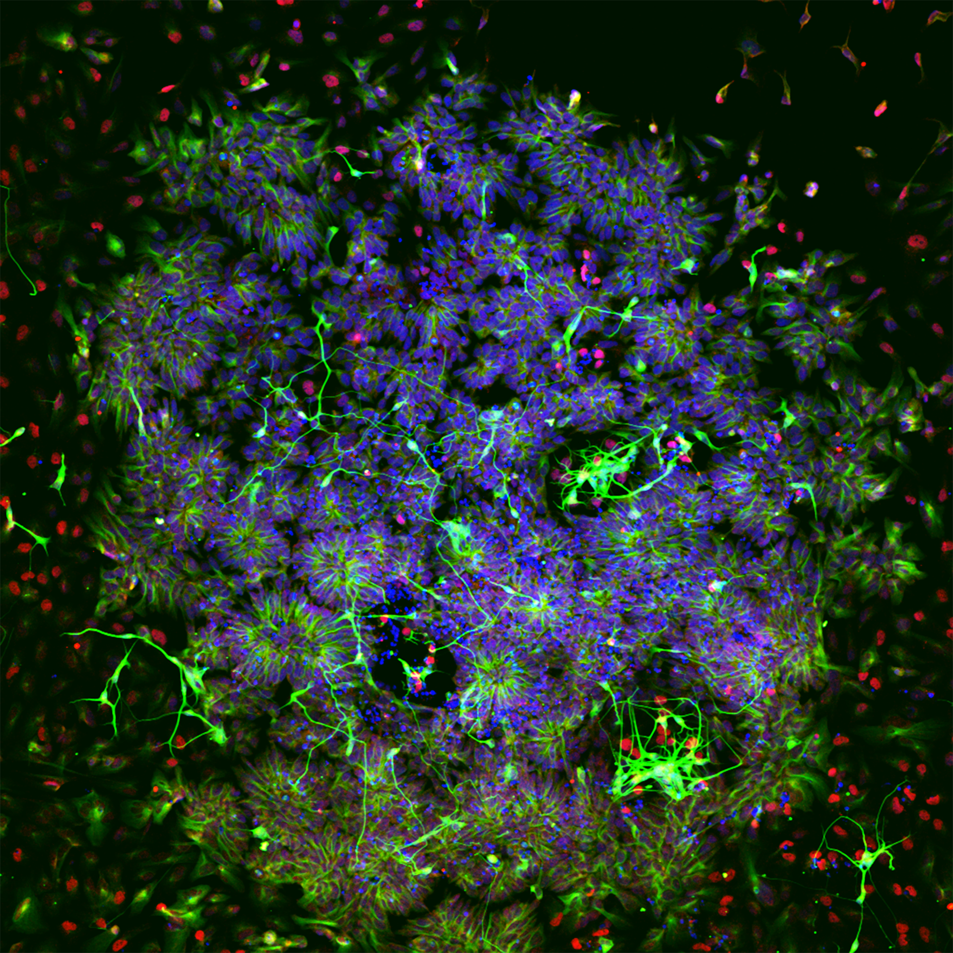 Fluorescence microscopy of a brain organoid